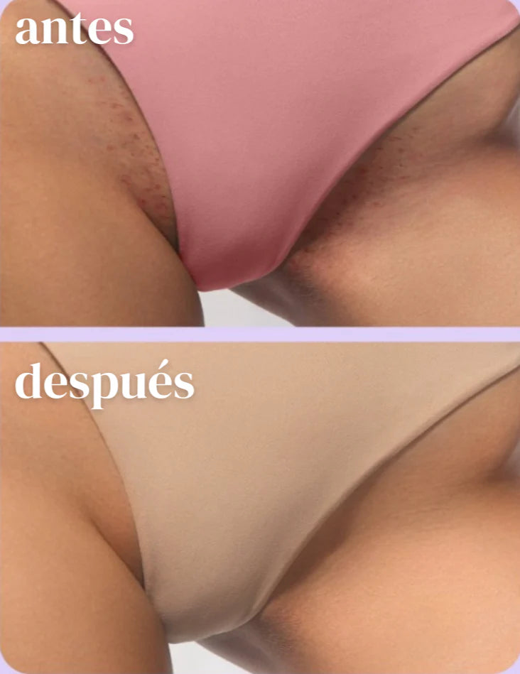 Combo Truly- Soft serve & Unicorn fruit