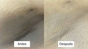 CREMA MOONWHITE K-Glow (Aclara manchas oscuras en 2 semanas y sin láser)