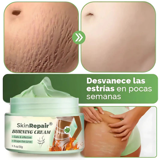 Crema SkinRepair™ – Borra Estrías y Reafirma tu Piel