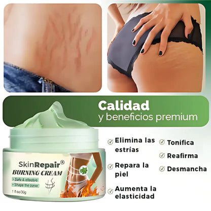 Crema SkinRepair™ – Borra Estrías y Reafirma tu Piel