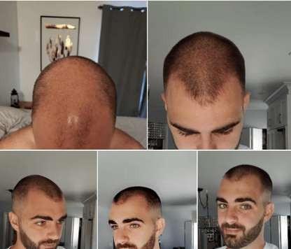 🧬Rolon Bodywise estimula el crecimiento de tu cabello con el efecto del romero