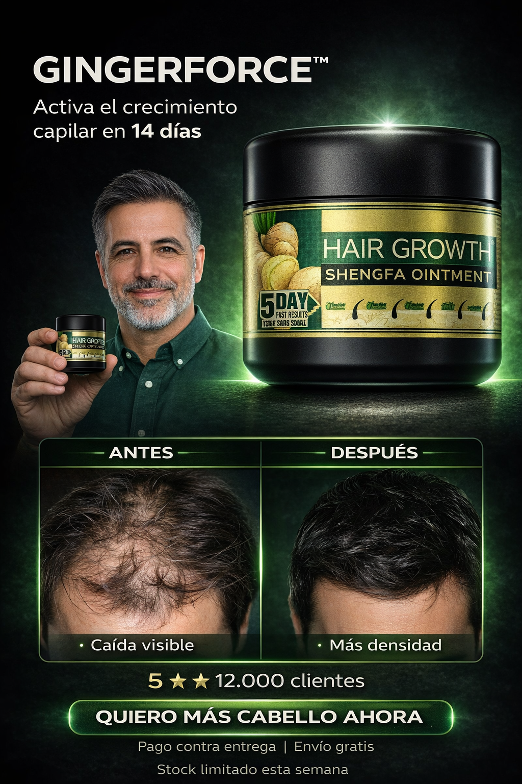 GingerForce™ – Activa el crecimiento capilar y frena la caída en 14 días