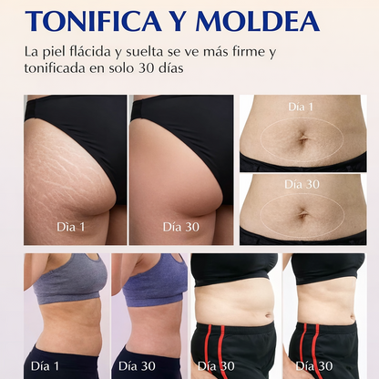 Golden Sweat: Borra estrías visibles y revierte la celulitis profunda en solo 18 días