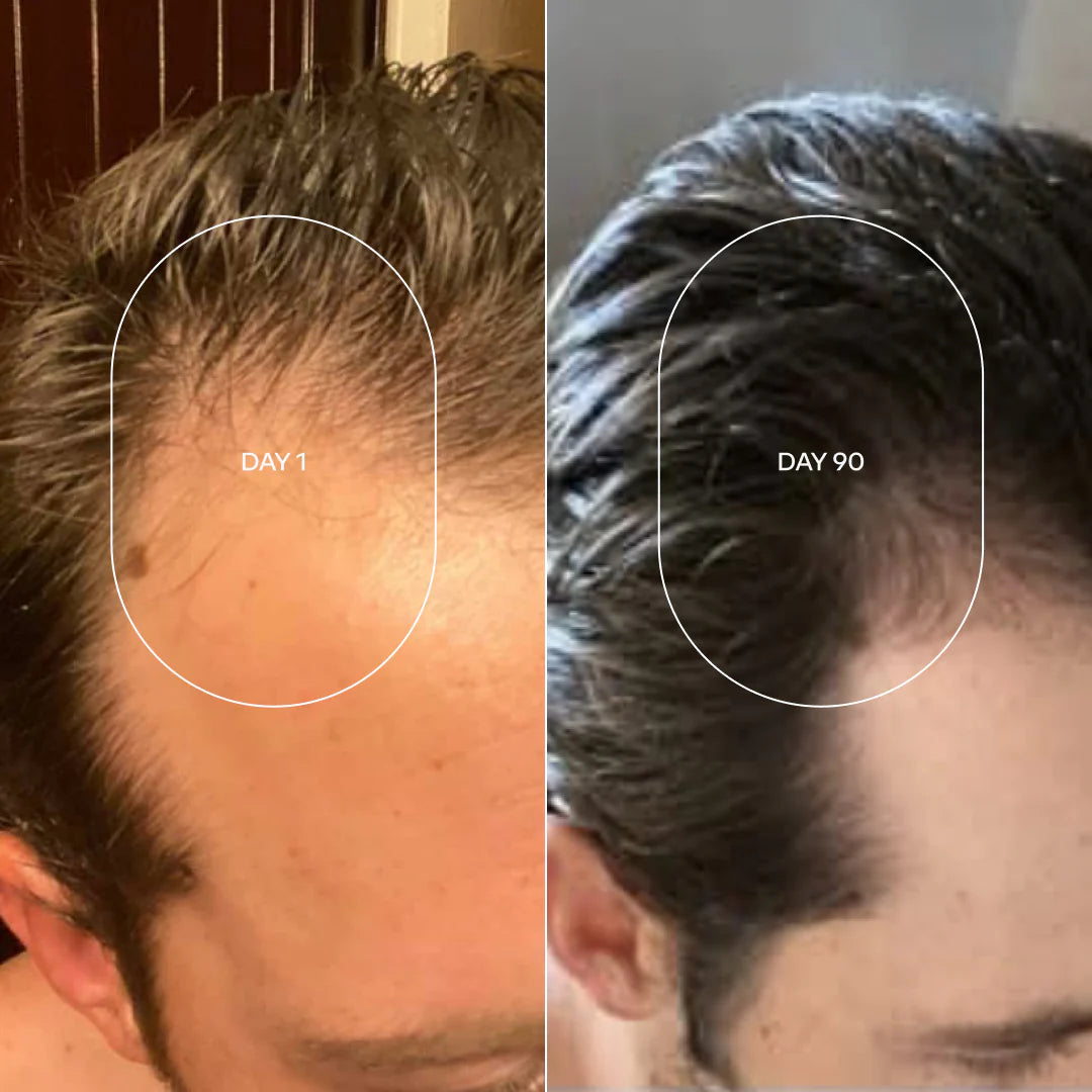 🧬Rolon Bodywise estimula el crecimiento de tu cabello con el efecto del romero