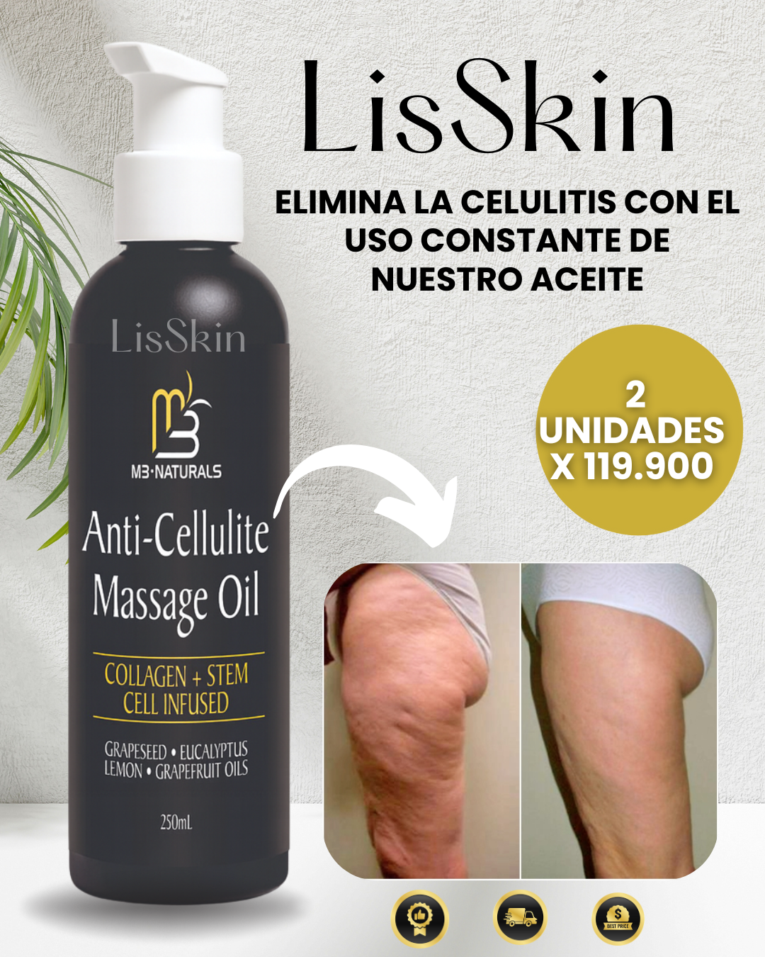 LisSkin - Despidete de la celutis con nuestro tratamiento en semanas