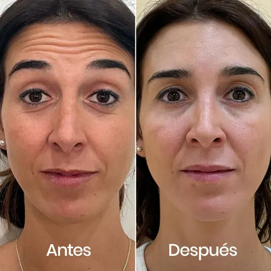 CREMA NIDA - Formula coreana para la piel arrugada 120ML