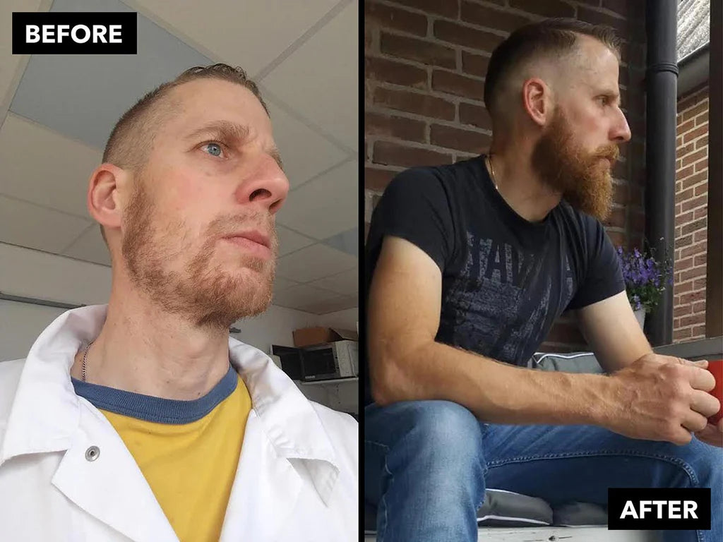 ROOT RENEWAL | Activa el crecimiento de la barba y rellena huecos con el romero